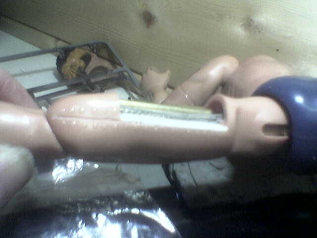 right side (inside thigh) of leg