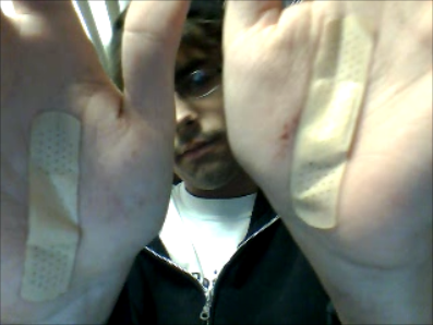 Poor hands..