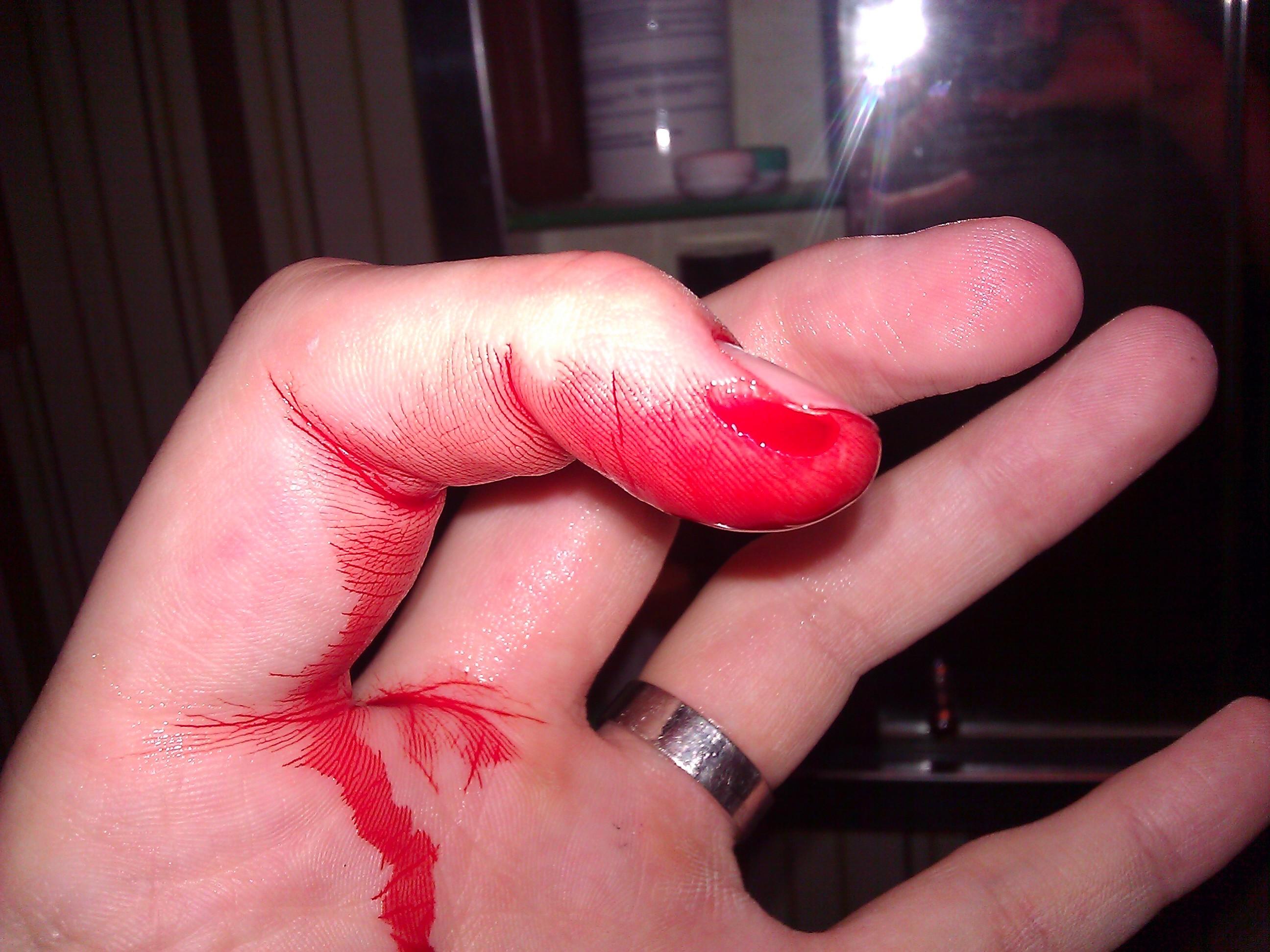 Cut my Finger, wouldnt stop bleeding (shaved a peice of the right part of my left index finger off)