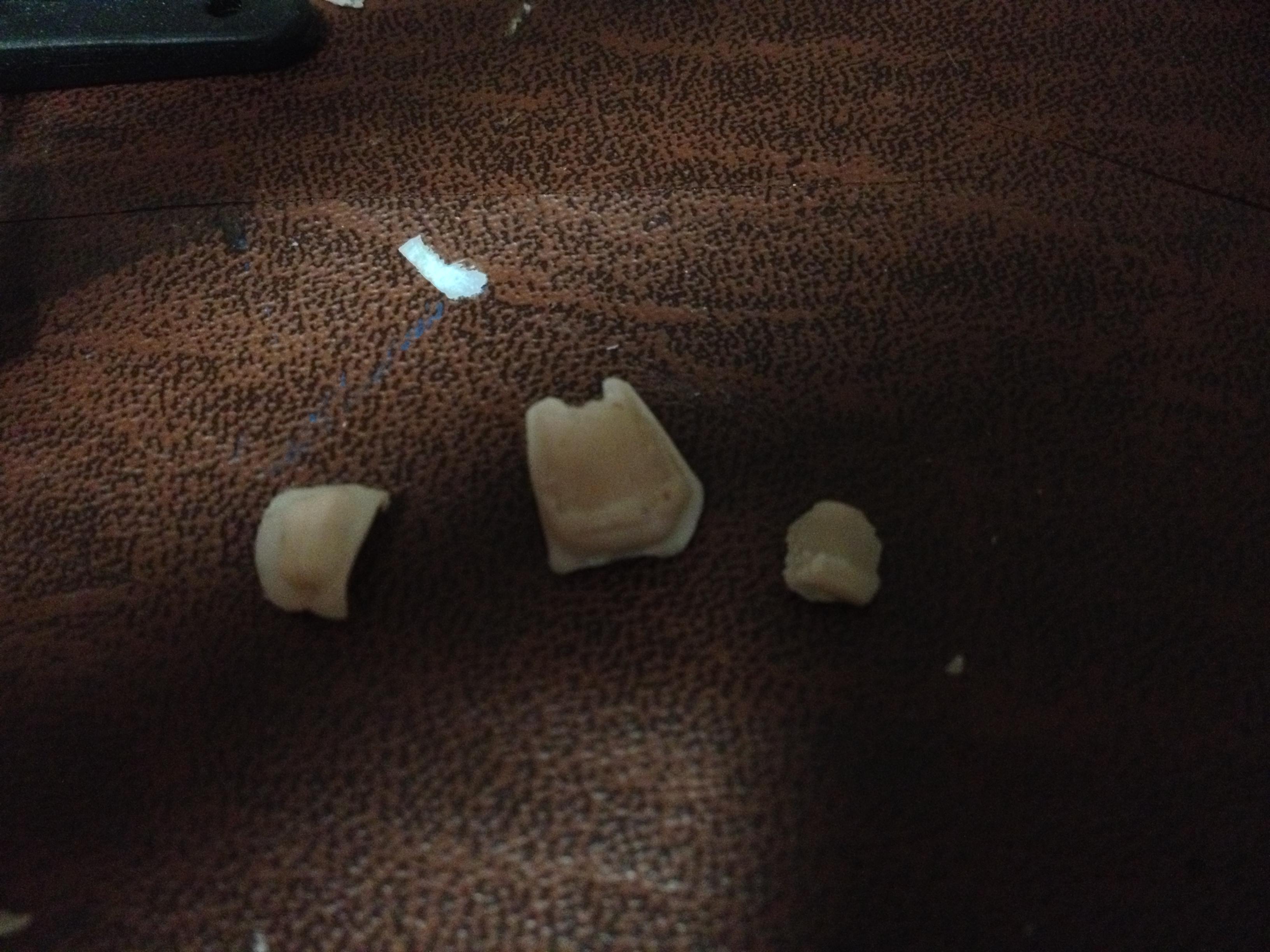Closeup on test casts (filing and trimming will be necessary)