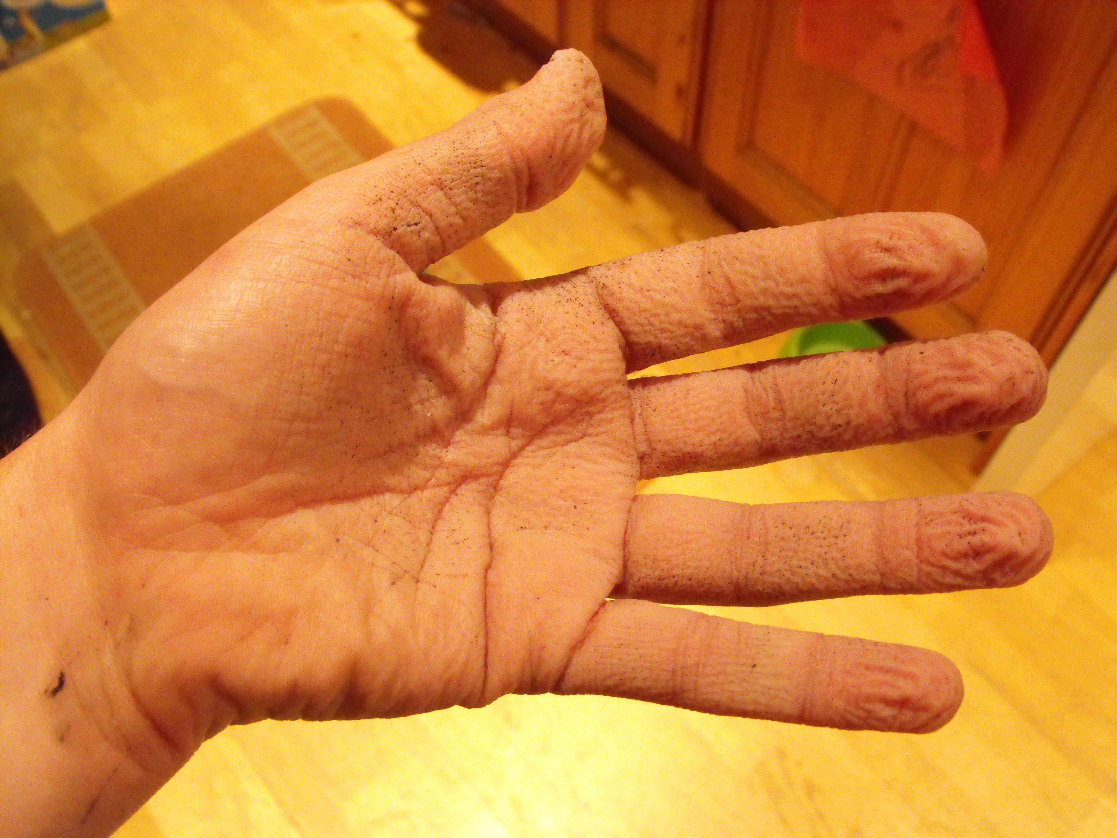 WEAR YOUR GLOVES!!!!!!
