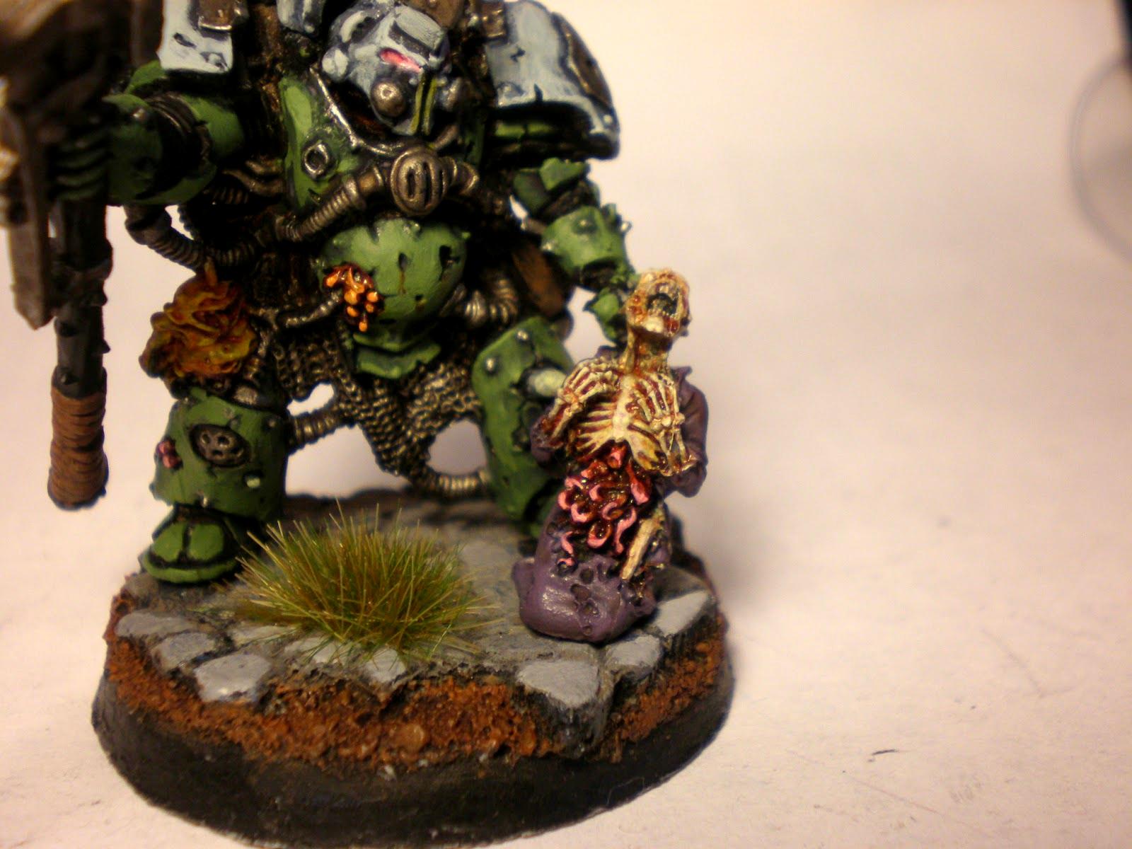 Typhus