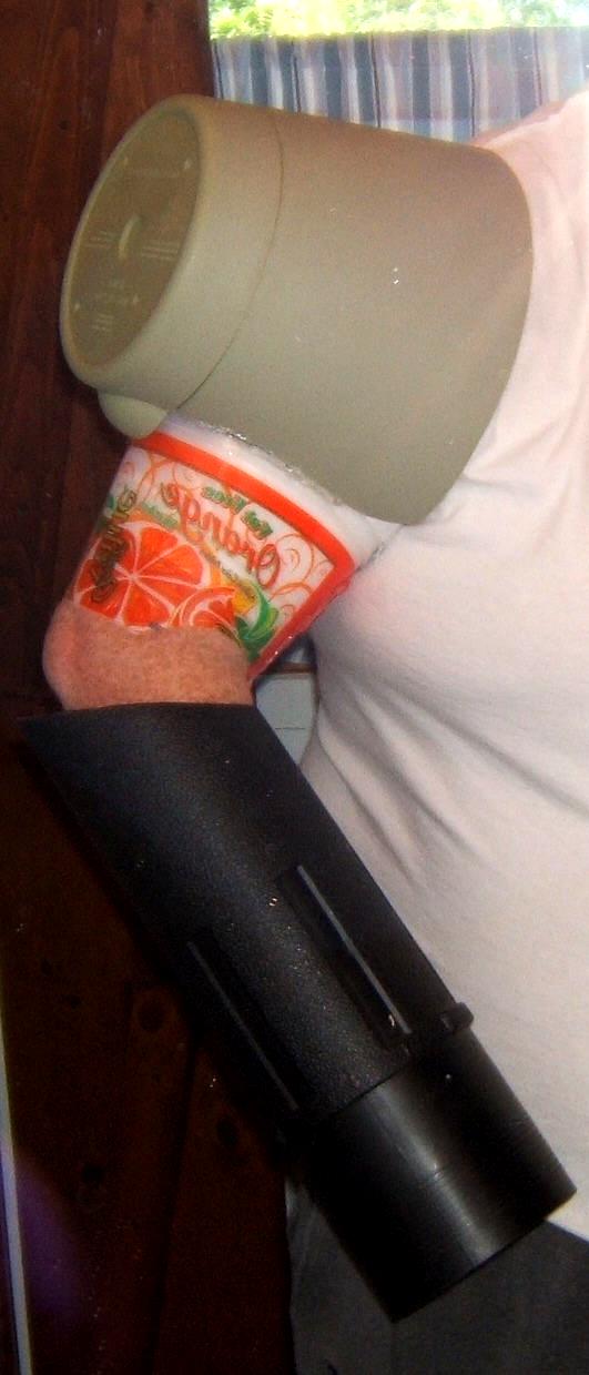 arm 1