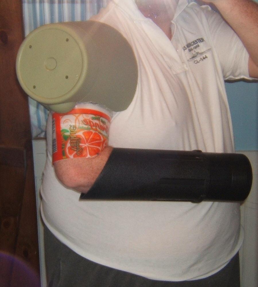 arm 2