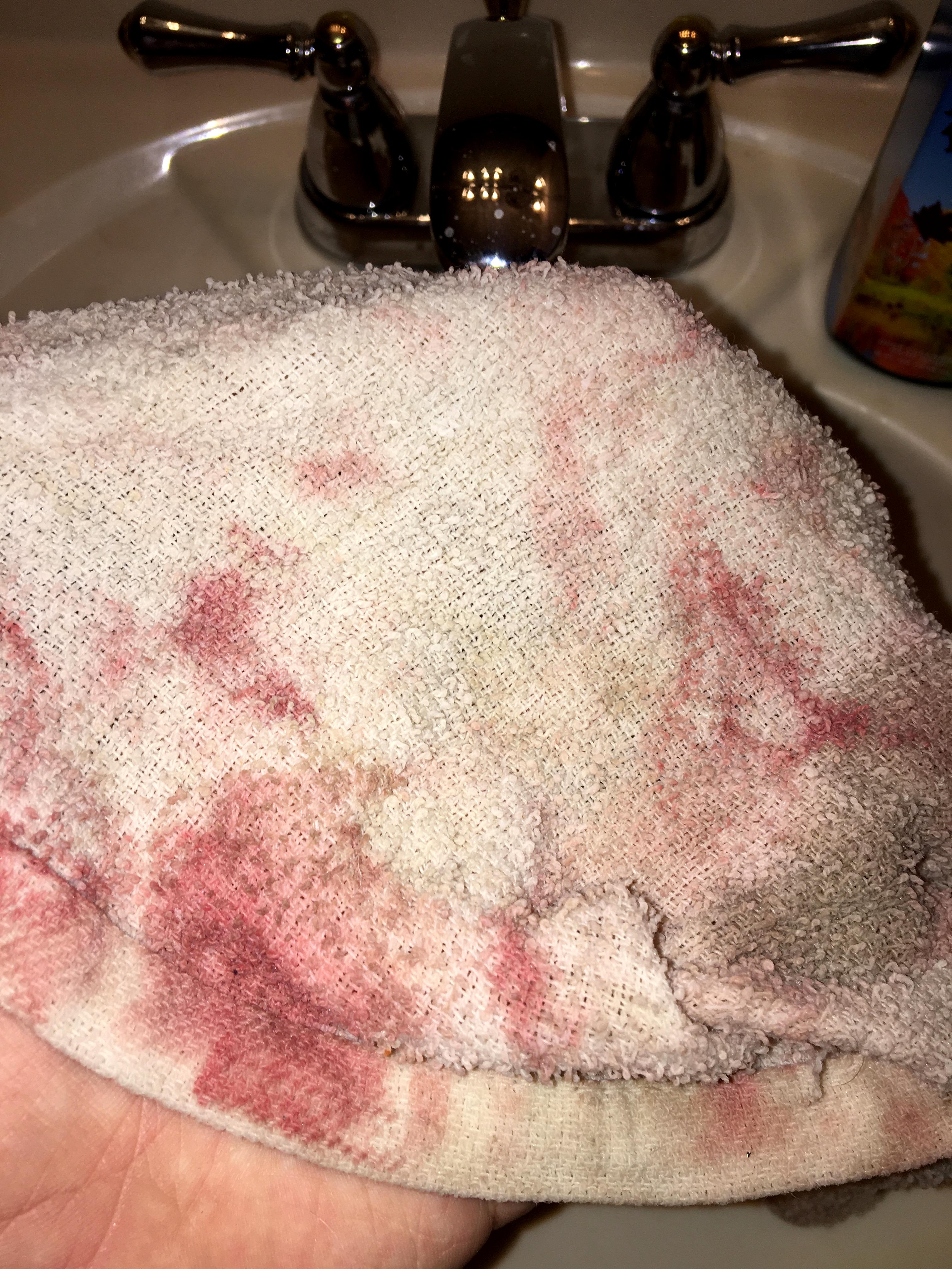 Don't try and wash out Typhus Corrosion