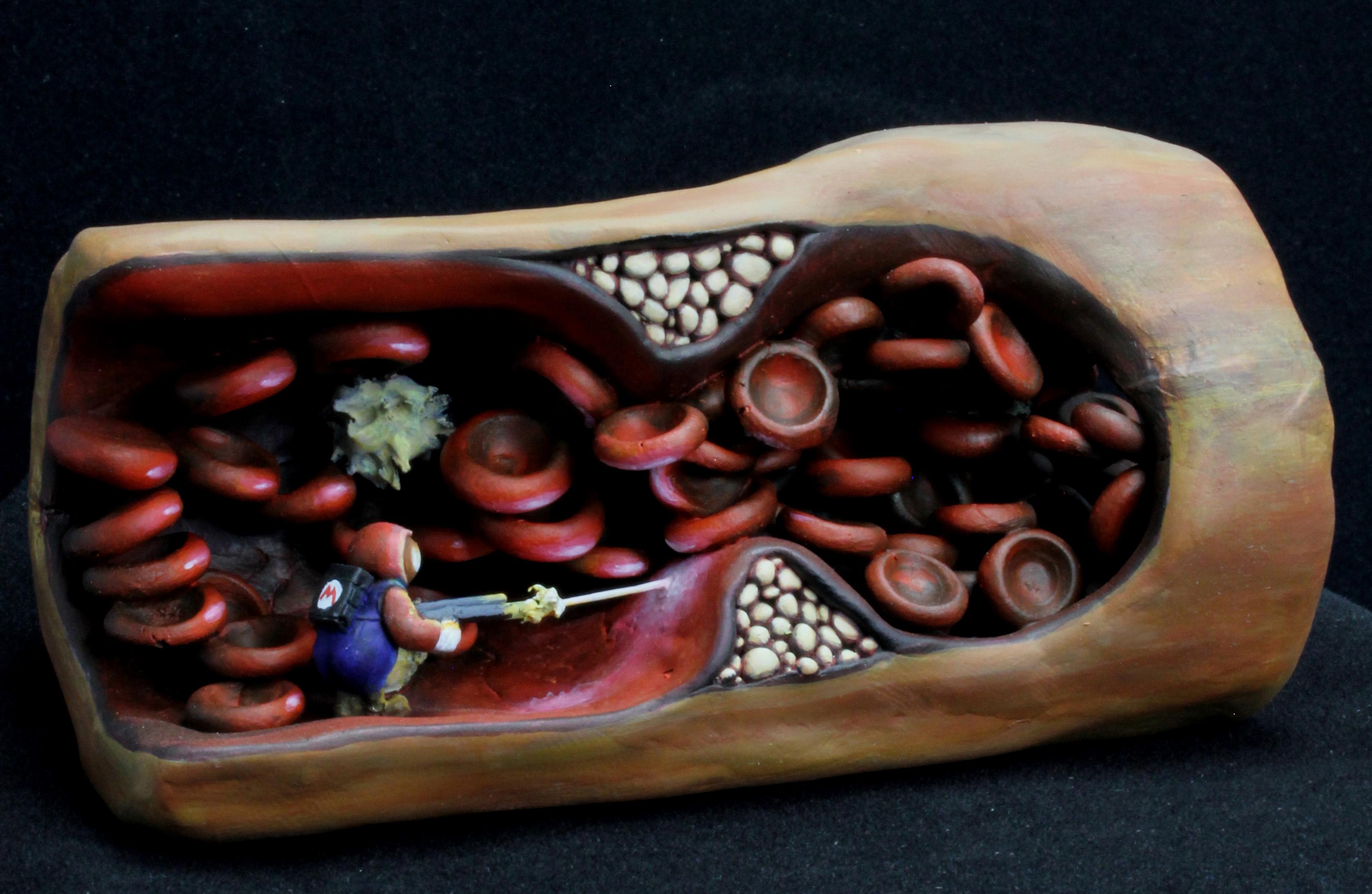 Bloodstream, Diorama, Shrink